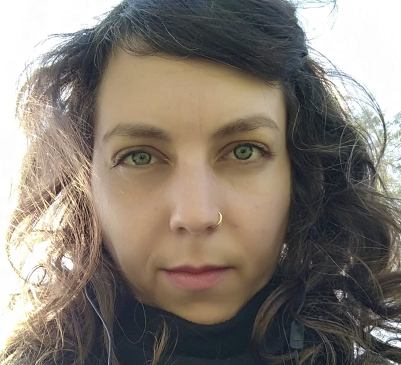 שר ניב קוקסינלית שתבעה למימון ניתוח נישוי פנים